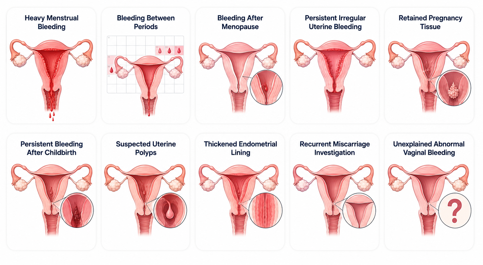 Dilation & Curettage (D&C)