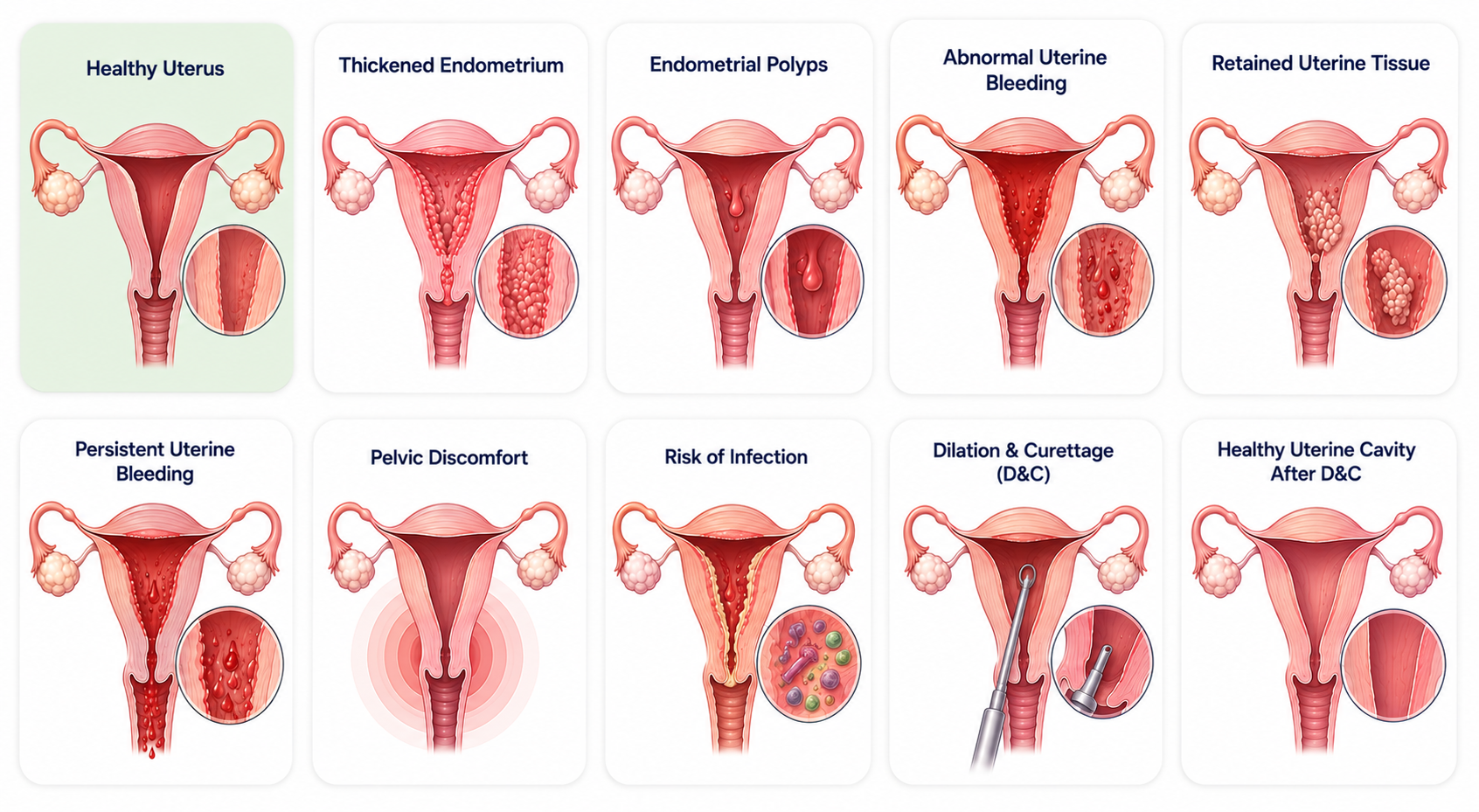 Dilation & Curettage (D&C)