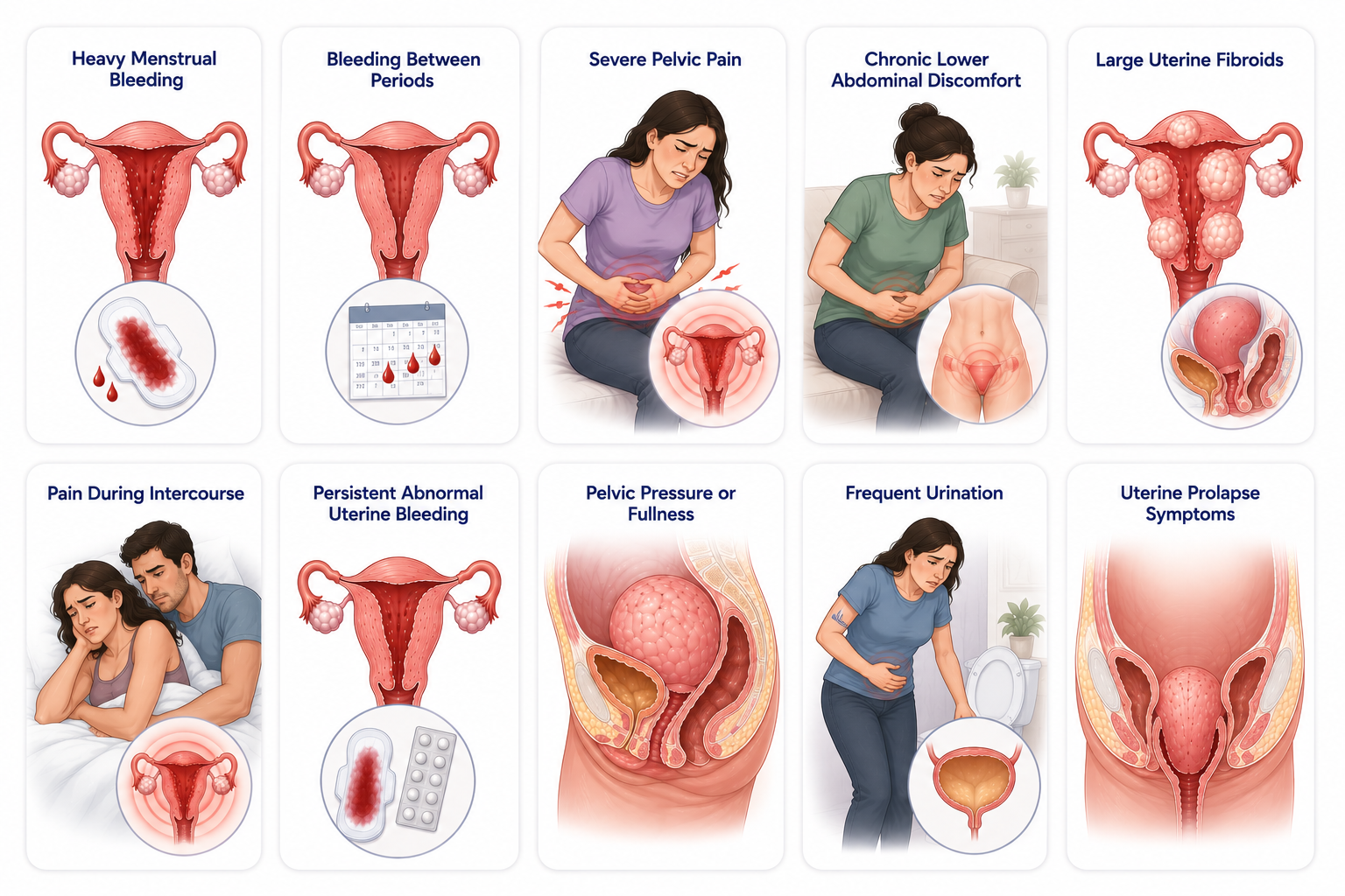 Hysterectomy