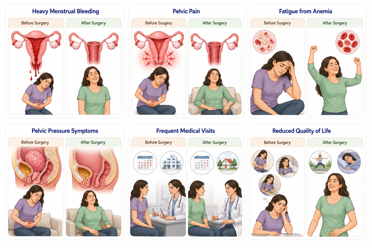 Hysterectomy