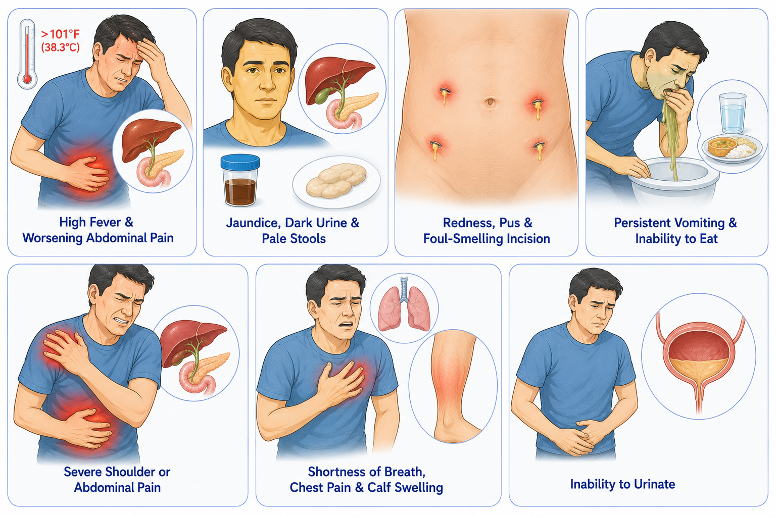 Gall bladder Removal