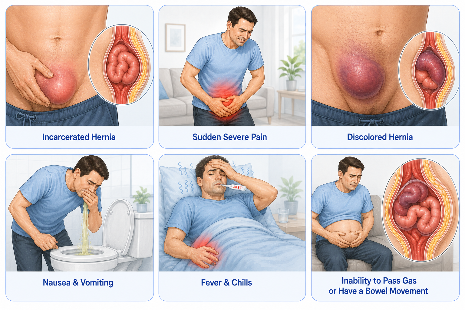 Hernia Surgery